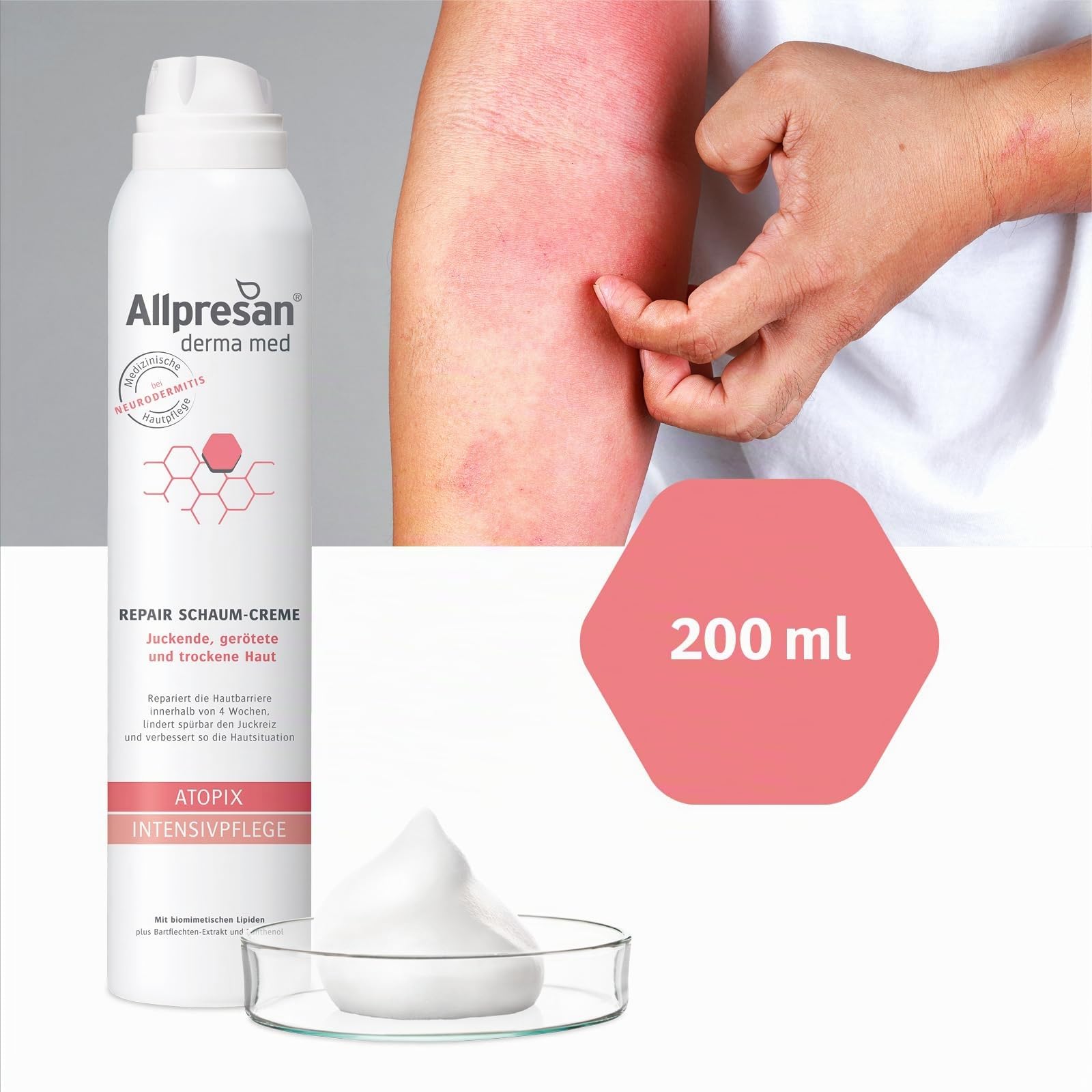 allpresan-atopix-derma-med-intensivpflege-schaum-creme-200-ml image 4
