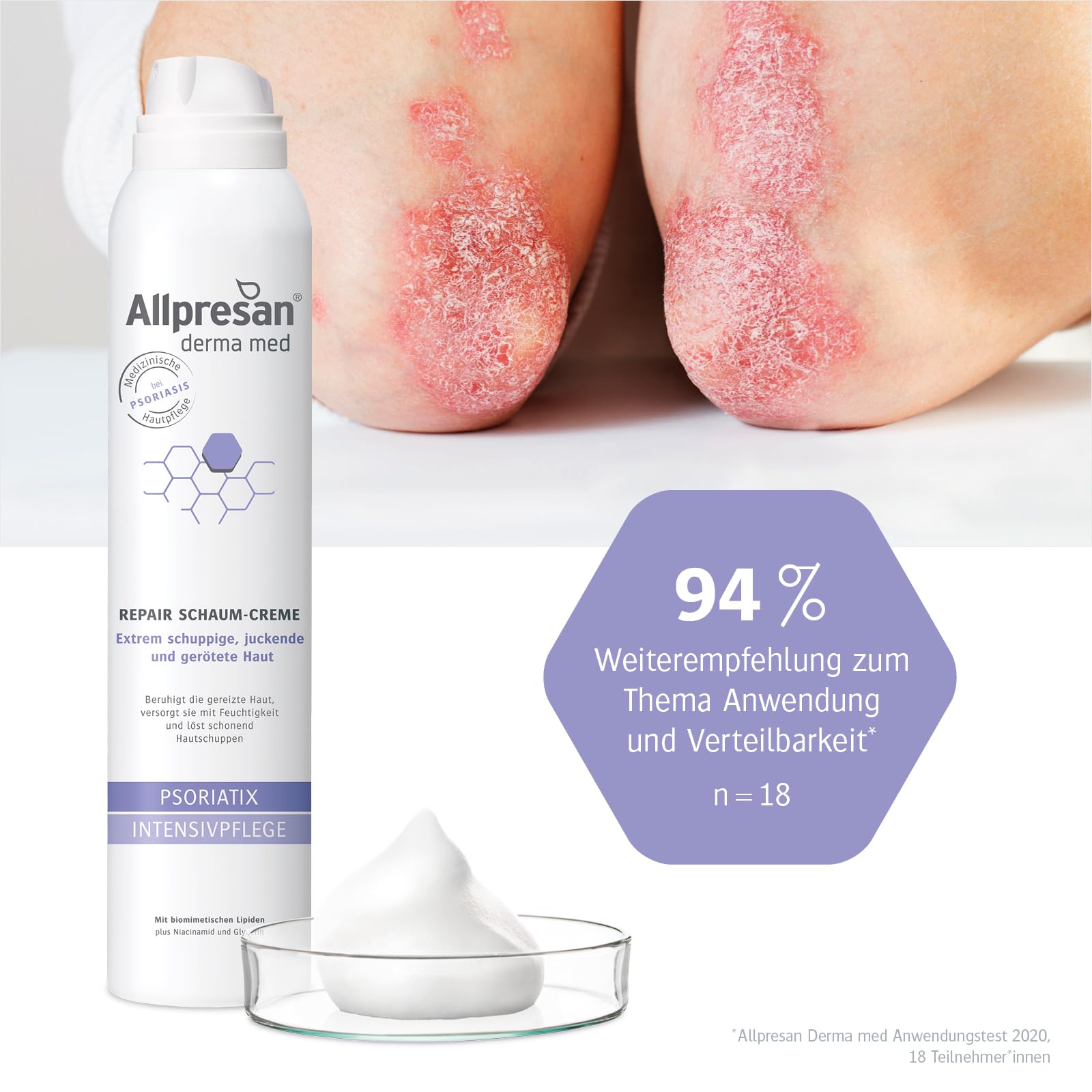 allpresan-psoriatix-repair-schaum-creme-creme-200-ml-psoriasis image 5